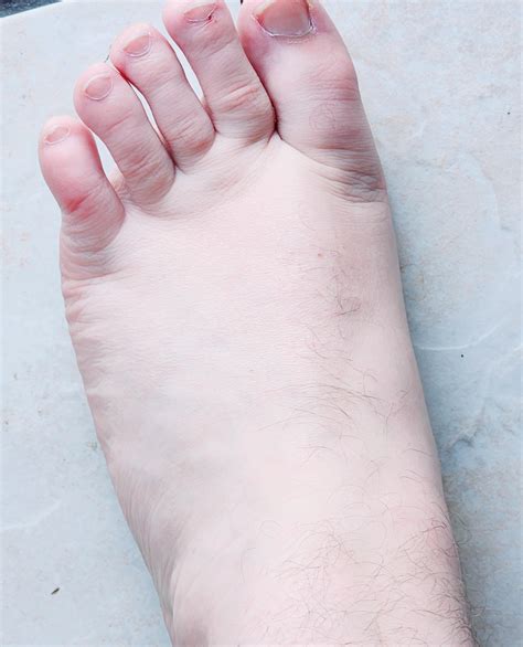 gross feet pictures|Gross Feet Photos, Download The BEST Free Gross Feet Stock。